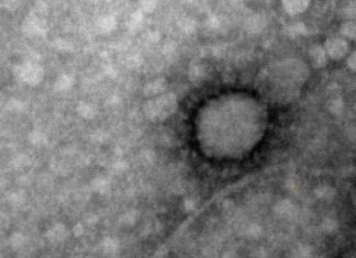 Coronavirus: 8.713 contagios y 382 muertos. Las peores 24 hs.