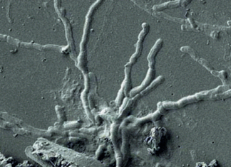 Dos siglos después de la erupción del Vesubio, encuentran neuronas intactas.